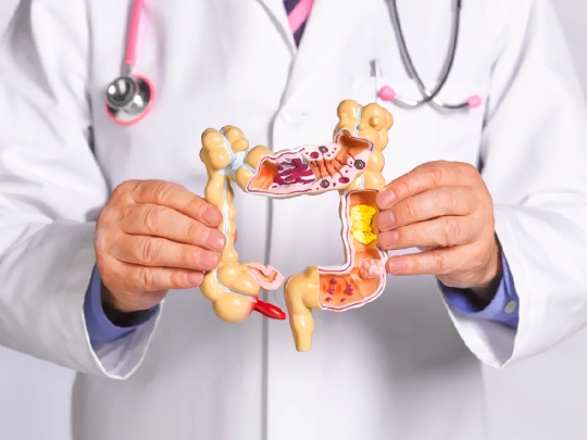 Colonic and Rectal Diseases