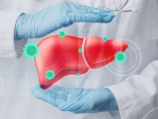 Hepatitis A, B, C, D, E