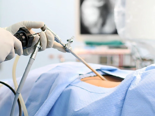 Laparoscopic Inguinal Hernia Surgery