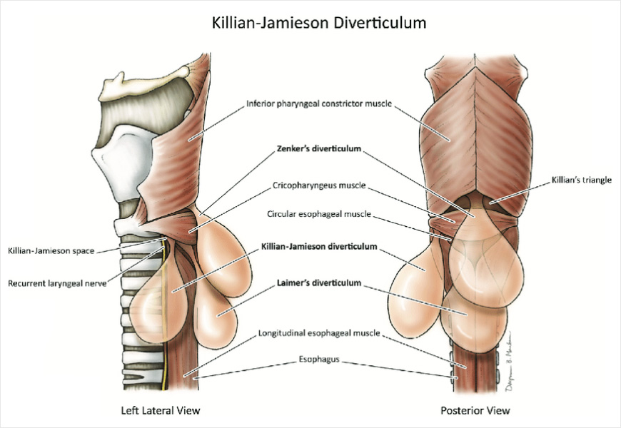 Killian Jameison